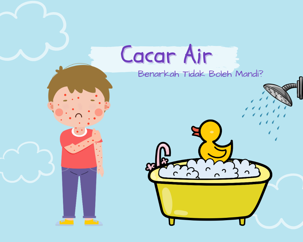 Anak Terkena Cacar Air, Benarkah Tidak Boleh Mandi?